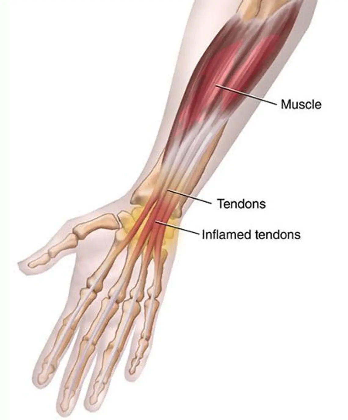 Extensor tendon of the forearm