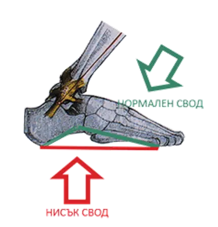 нисък свод