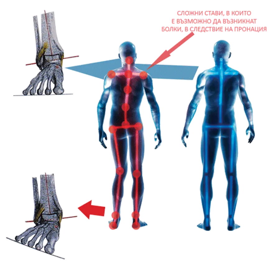 стави, в които е възможно да възникнат болки в следствие на пронация